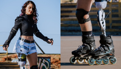 Ação Solidaria: Prótese para a Patinadora Alessandra Gianinni